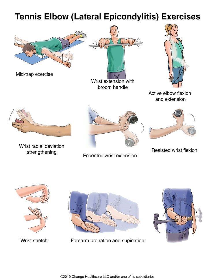 Tennis-Elbow-Exercises