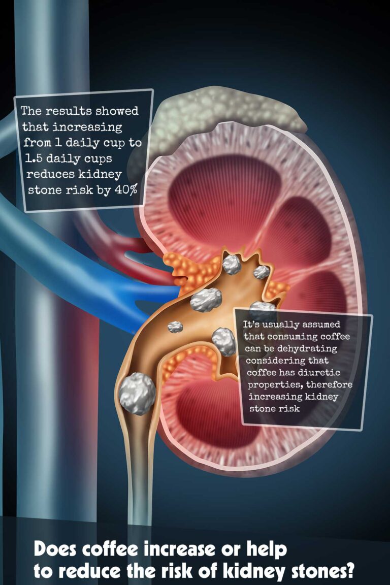 Does-coffee-increase-or-help-to-reduce-the-risk-of-kidney-stones