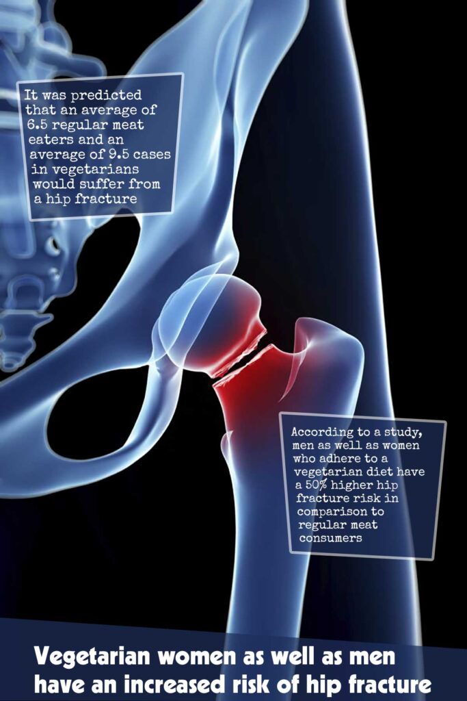 Vegetarian Women as Well as Men Have an Increased Risk of Hip Fracture